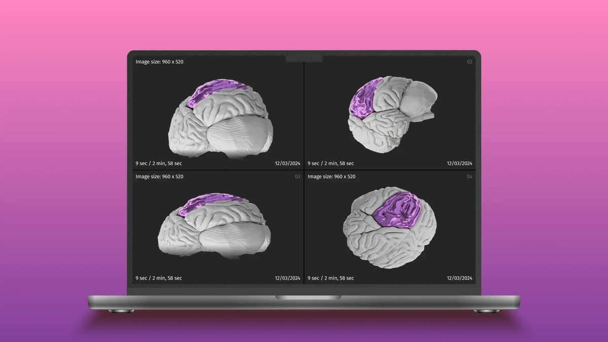 3D Medical Imaging Software Development